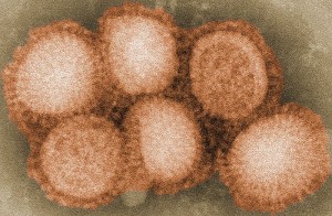 H1N1 Avian Flu