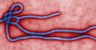 Electron micrograph of an Ebola virus virion. Photo created by CDC microbiologist Cynthia Goldsmith, Wikipedia Commons.