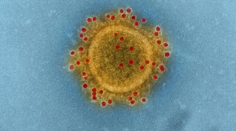 Middle East Respiratory Syndrome Coronavirus particle envelope proteins immunolabeled with Rabbit HCoV-EMC/2012 primary antibody and Goat anti-Rabbit 10 nm gold particles. Credit NIAID