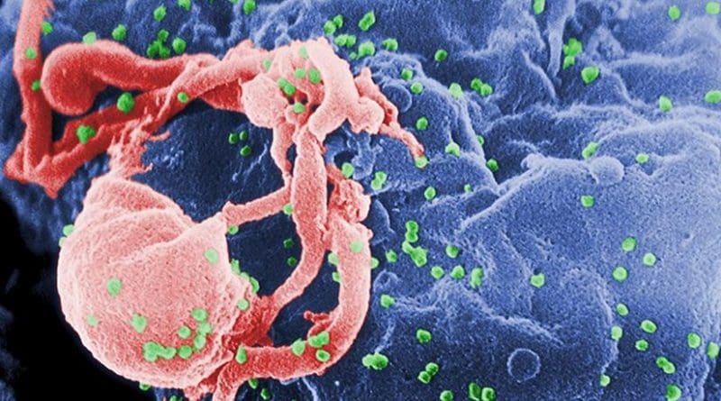 Scanning electron micrograph of HIV-1 (in green) budding from cultured lymphocyte. Multiple round bumps on cell surface represent sites of assembly and budding of virions. Photo Credit: C. Goldsmith, CDC, Wikipedia Commons.