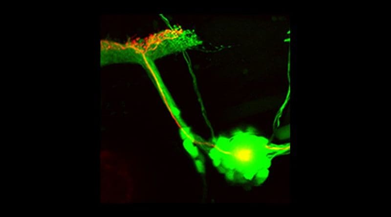 Zebrafish neurons projecting to the brain (green). One neuron expresses a light-activatable enzyme (red). Scientist were able to stimulate the regeneration of injured neurons using optogenetics. Source: Helmholtz Zentrum München