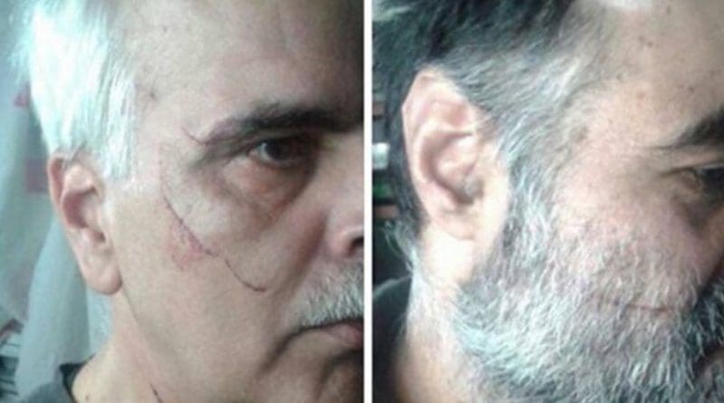 Scarred Iranian political prisoners. Photo Credit: Kaleme website.