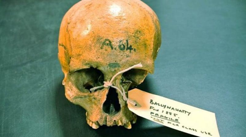 Excavated near Belfast in 1855, she had lain in a Neolithic tomb chamber for 5,000 years; subsequently curated in Queens University Belfast. Credit: Daniel Bradley, Trinity College Dublin