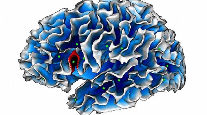 Mapping of cortical fold depths. In green: sulcal pits (the deepest point of each fold). In red: localization of the abnormality detected in autistic children (in Broca's area). © SCALP team / INT