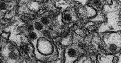 This is a transmission electron micrograph (TEM) of Zika virus, which is a member of the family Flaviviridae. Virus particles are 40 nm in diameter, with an outer envelope, and an inner dense core. Photo Credit: CDC/ Cynthia Goldsmith, Wikipedia Commons.