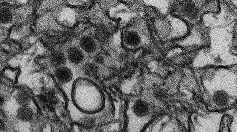 This is a transmission electron micrograph (TEM) of Zika virus, which is a member of the family Flaviviridae. Virus particles are 40 nm in diameter, with an outer envelope, and an inner dense core. Photo Credit: CDC/ Cynthia Goldsmith, Wikipedia Commons.