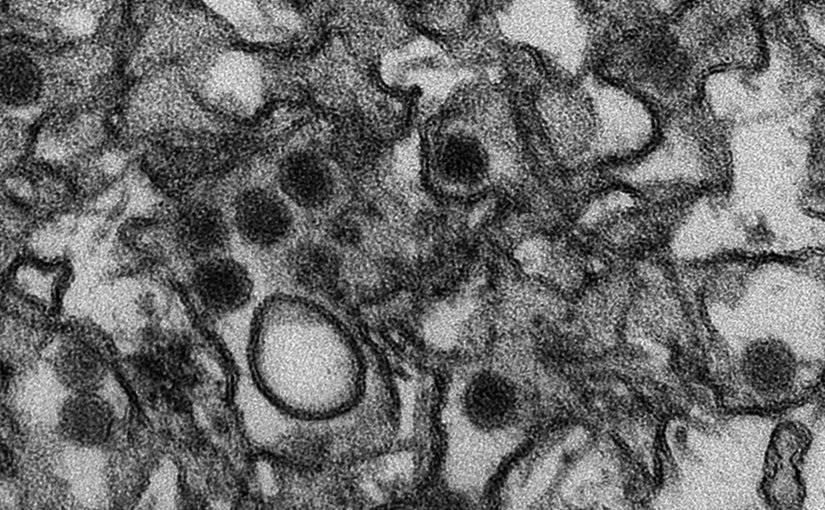 This is a transmission electron micrograph (TEM) of Zika virus, which is a member of the family Flaviviridae. Virus particles are 40 nm in diameter, with an outer envelope, and an inner dense core. Photo Credit: CDC/ Cynthia Goldsmith, Wikipedia Commons.