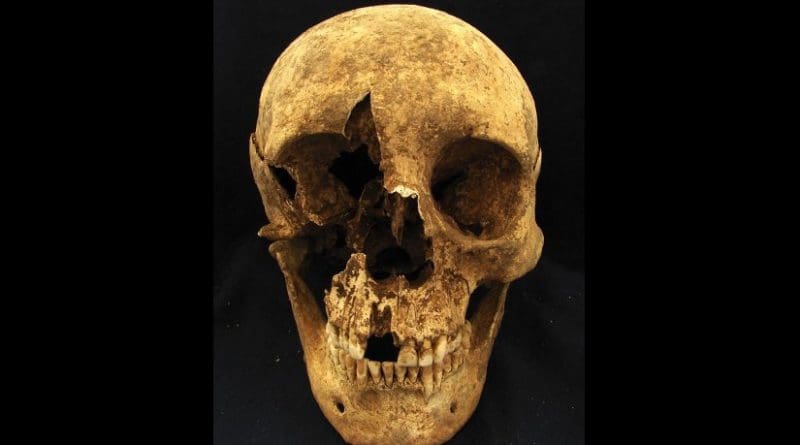 Skull of skeleton T15, a 35- to 50-year-old male who was buried in a cemetery in the modern neighborhood of Casal Bertone, Rome, Italy. Isotope ratios suggest he may have been born near the Alps. Credit: Kristina Killgrove