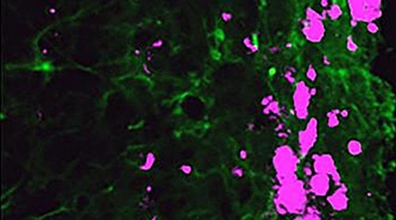 Reprogrammed stem cells (green) chase down and kill glioblastoma cells (pink), potentially offering a new and more effective treatment option for a disease that has not had any in more than 30 years. Credit UNC Eshelman School of Pharmacy