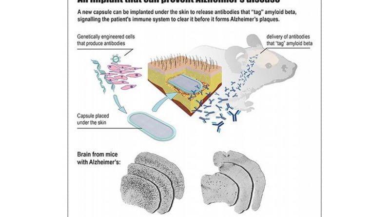 This is an infographic of how the implanted capsule releases antibodies to the brain. Credit Patrick Aebischer (EPFL)
