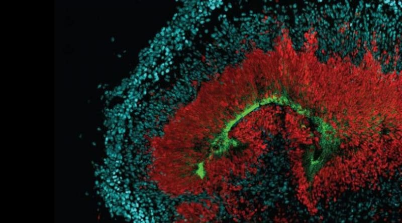 This image shows a section through a stem cell-derived cerebral organoid (mini-brain in a dish) where the radial glia stem cells are shown in red, neurons are in blue, and the AXL receptors are in green. Credit Elizabeth Di Lullo
