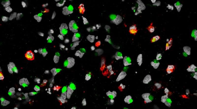 This image shows cell death of the human neural progenitor cells (hNPCs) is mark by cleaved caspase 3 in red, the nuclei of hNPCs are labeled by DAPI in white/grey, and the ZIKA virus is labeled by ZIKA virus envelope protein in green. Credit Sarah C. Ogden
