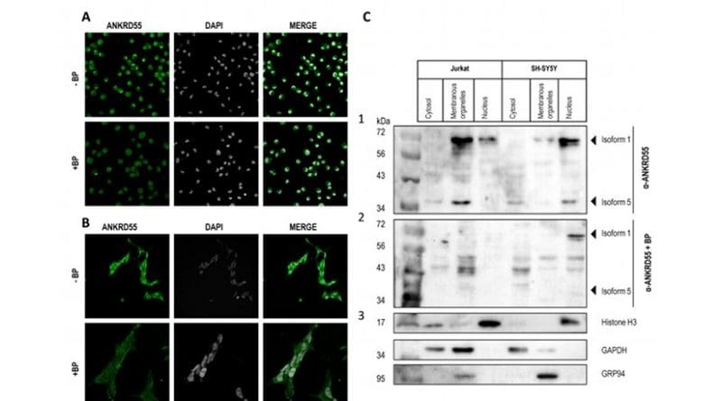 Intracellular localization of ANKRD55 in Jurkat, SH-SY5Y and PMA-treated U937 cells.