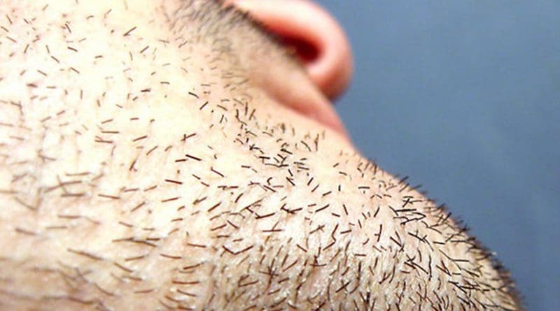 beard hair
