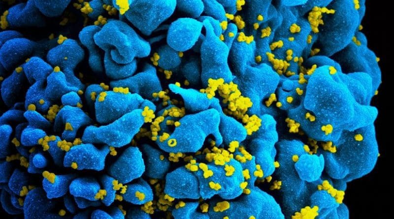 HIV particles (yellow) infecting a T cell, viewed under a scanning electron microscope. T-cells perform important functions in our immune system. Credit NIH/NIAID