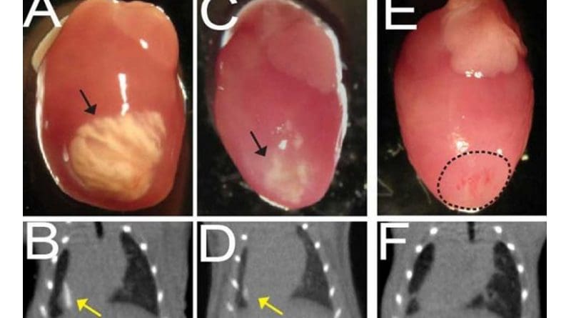 The figure shows calcium deposits in the hearts of mice (A,D) and the effect of two drugs, ARL67156 (B,E) and etidronate (C,F), in decreasing the extent of calcium deposits after heart injury. Credit Pillai and Li et al./Cell Stem Cell 2016