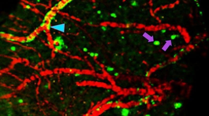 Researchers at Washington University School of Medicine in St. Louis have developed a chemical compound that detects the Alzheimer's protein amyloid beta better than current FDA-approved agents. The compound potentially may be used in brain scans to identify people in the earliest stages of Alzheimer's disease. In the image above, the compound has passed from the bloodstream of a living mouse into its brain, where it is detected by a positron emission tomography (PET) scan. Arrows indicate clumps of amyloid beta. Credit Ping Yan and Jin-Moo Lee