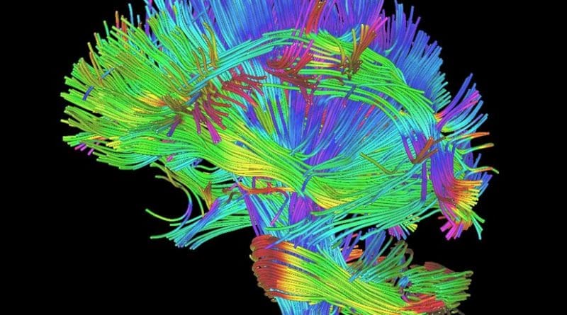 This is an example of a white matter rendering from DTI and DKI scans. The diffusion metrics used in this study were derived from DTI and DKI scans. The metrics give measures of the integrity of these white matter fibers. Credit Radiological Society of North America