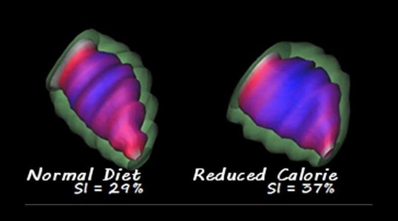 Offspring of undernourished mother has more spherical shaped heart than control. Credit Dr. Peter Nathanielsz and Dr. Geoffrey Clarke