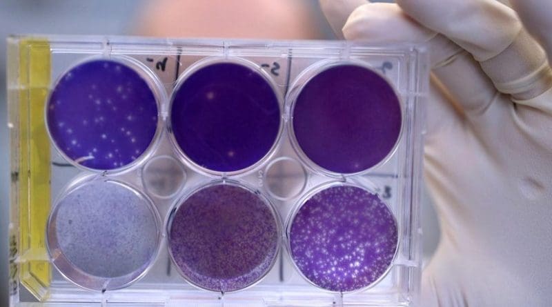 A researcher holds a tray of Zika virus growing in animal cells at Washington University School of Medicine in St. Louis. There is no treatment available to block Zika virus in a pregnant woman from infecting her fetus and potentially causing severe birth defects. But researchers have identified a human antibody that prevents, in pregnant mice, the fetus from becoming infected and the placenta from being damaged. The antibody also protects adult mice from Zika disease. Credit Huy Mach