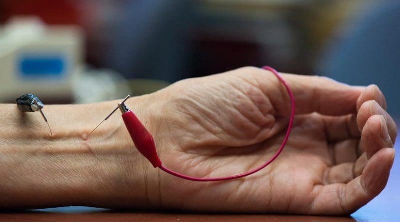 The UCI study shows that repetitive electroacupuncture evokes a long-lasting action in lowering blood pressure in hypertension. Credit Chris Nugent / UCI