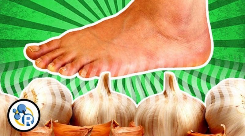 Did you know you can "taste" garlic with your feet? Credit The American Chemical Society