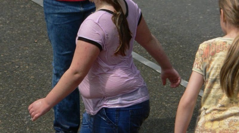 Children with varying proportion of body fat. Photo by Walter Siegmund, Wikipedia Commons.