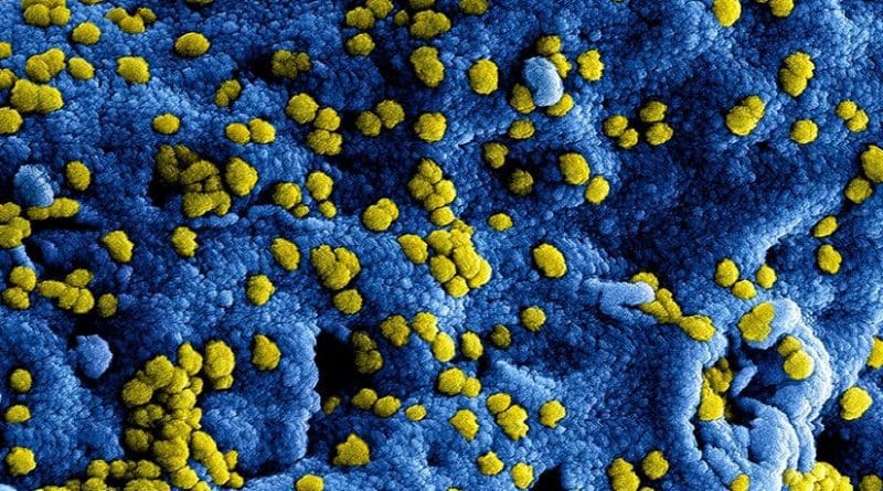 MERS particles are attached to the surface of an infected human cell. Credit NIAID