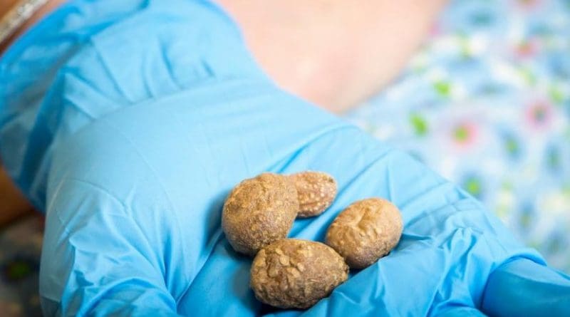 Louderback holds the tiny tubers of S. Jamesii, the Four Corners potato. U researchers discovered the spud's starch residues in the crevices of a 10,900-year-old stone tool in Escalante, Utah -- the earliest evidence of wild potato use in North America. Credit University of Utah