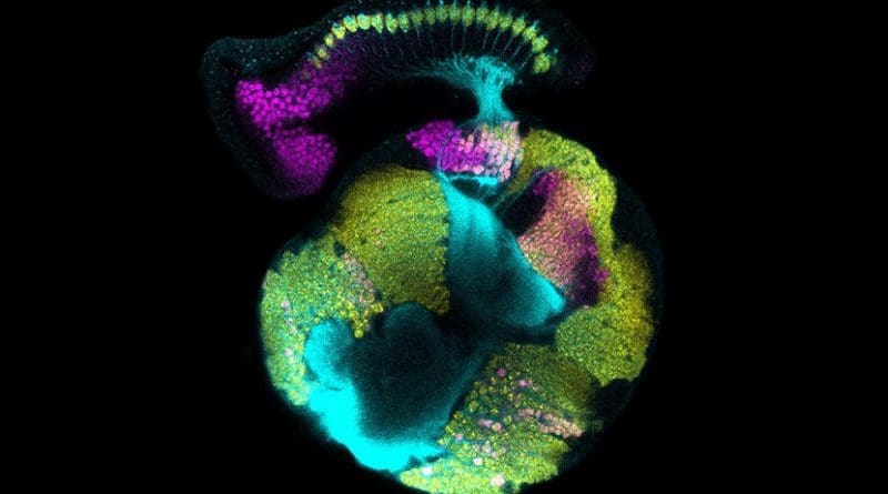 A confocal micrograph of a developing fruit fly visual system. Development of the retina (top) is coordinated with development of the optic lobe region of the brain (sphere below). All neurons are marked by yellow and their axon projections in cyan; magenta in the optic lobe marks the specific region of the brain where neuronal differentiation is regulated by glia. Credit Courtesy of Vilaiwan M Fernandes, Desplan Lab, NYU's Department of Biology.