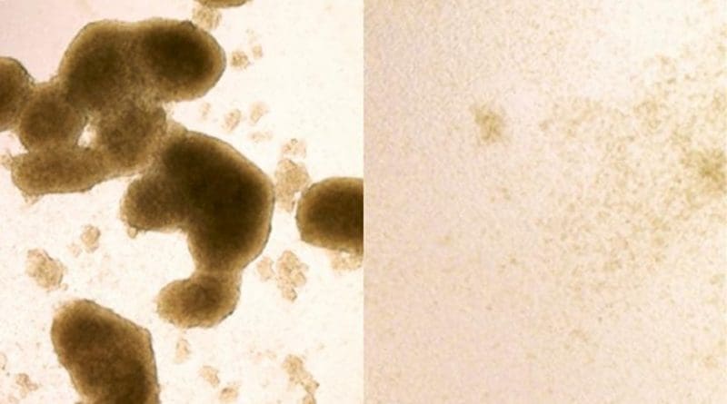 Brain cancer stem cells (left) are killed by Zika virus infection (image at right shows cells after Zika treatment). A new study shows that the virus, known for killing cells in the brains of developing fetuses, could be redirected to destroy the kind of brain cancer cells that are most likely to be resistant to treatment. Credit Zhe Zhu