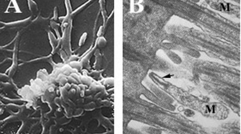 A) Filamentous Mycoplasma pneumoniae cells B) M. pneumoniae cells (M) attached to ciliated mucosal cells by the attachment organelle (indicated by arrow). Photo Credit: Rottem et al., Wikipedia Commons.