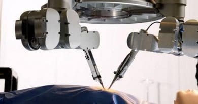 Plastic surgeons at Maastricht University Medical Center have used a robotic device to surgically treat lymphedema in a patient. This is the world's first super-microsurgical intervention with 'robot hands'. Credit Microsure