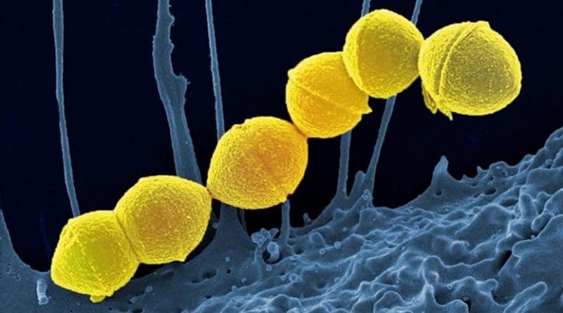 Group A Streptococci, colored yellow, are the most common culprits in bacterial upper respiratory infections. The Georgia Tech researchers suggest finding alternatives to broader spectrum antibiotics to take care of such ailments in order to preserve antibiotic effectiveness longer for more extreme infections. Credit National Institute of Allergy and Infectious Diseases of the NIH