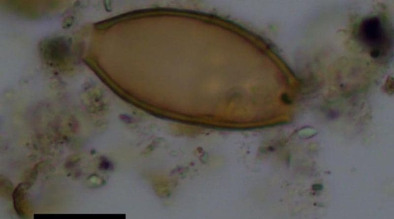These are eggs of whipworm intestinal parasites from ancient Greek samples analysed in the study. Credit Reproduced with the permission of Elsevier publishing.