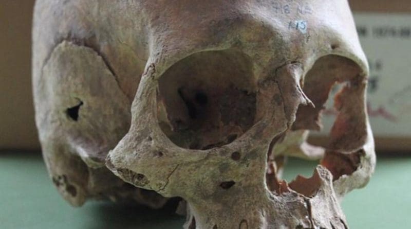 This is one of the female skulls from the Repton charnel. Credit Cat Jarman