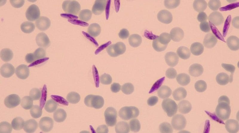 Gametocytes of p. falciparum in human red blood cells. Credit Eva Hitz/Swiss TPH