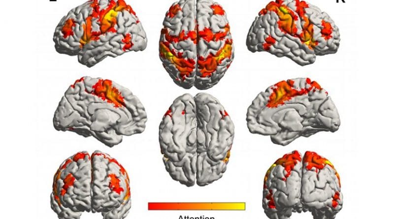 This is a diagram of brain networks involved in processing attention. Credit Brain Network Lab