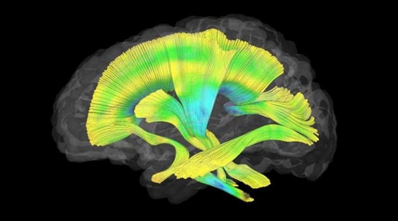 This image shows all of the white matter fiber tracts investigated in this study. Credit Meghan Swanson, PhD, UNC-Chapel Hill