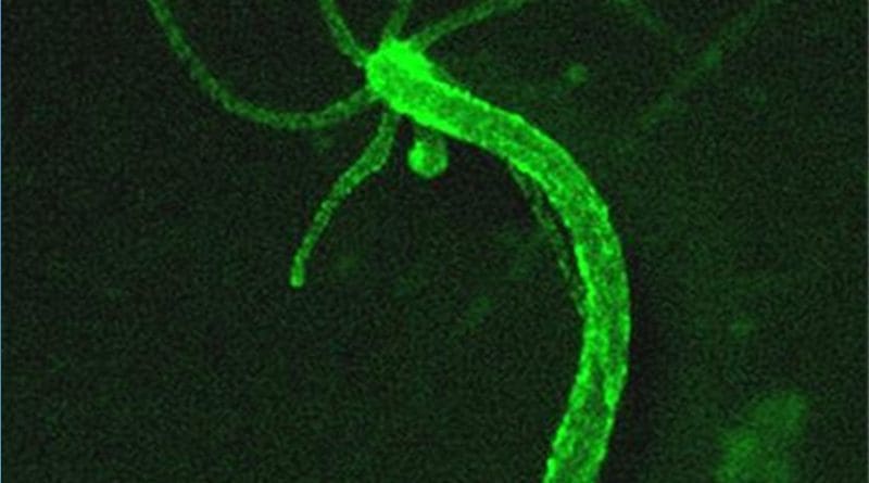 Researchers show how an algorithm for filtering spam can learn to pick out, from hours of video footage, the full behavioral repertoire of tiny, pond-dwelling Hydra. In the above image, hydra's neurons are labeled with a green fluorescence indicator. Credit Yuste Lab, Columbia University