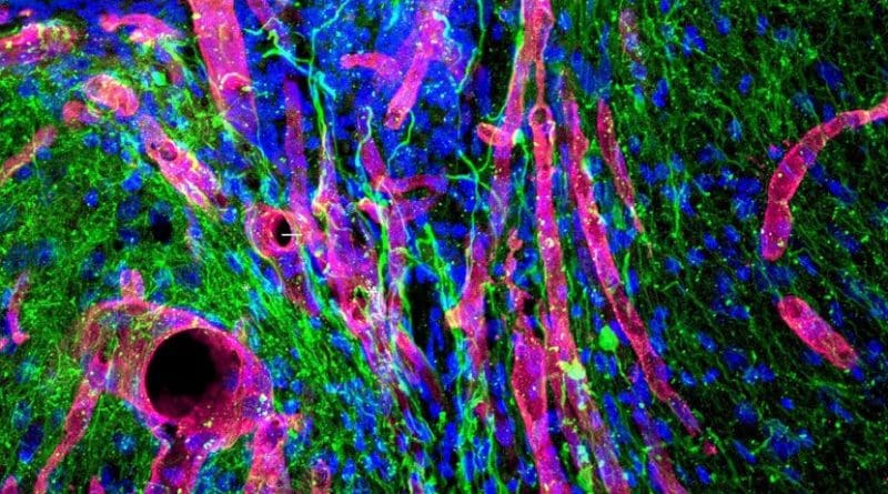 This is a photomicrograph of tissue that has grown into the stroke cavity in the stroke-healing gel. The red tubes are blood vessels. They are growing into the site of the stroke in the center of the image. The green filaments are axons. These grow along the blood vessels as they enter the gel and infarct area. The blue ovoids are cell nuclei in the tissue. Credit UCLA Health