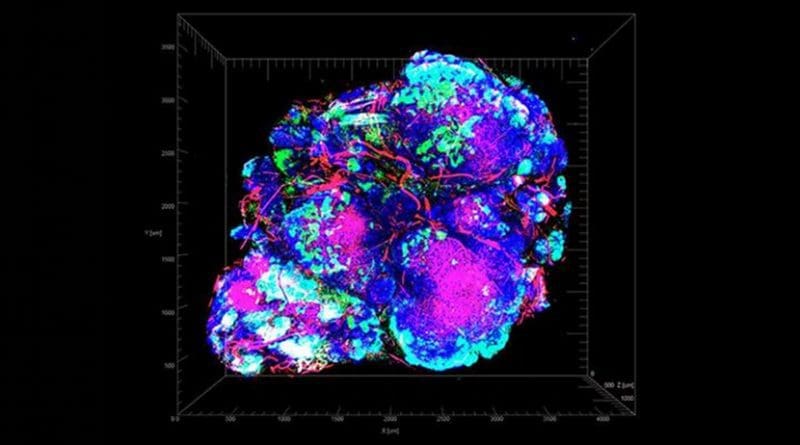 In this tumor, imaged in a mouse model of breast cancer, oxygen-low areas appear in green. These regions tend to resist standard cancer treatments. Credit Laboratory of Metabolic Regulation and Genetics at The Rockefeller University