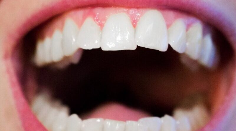 teeth dentist