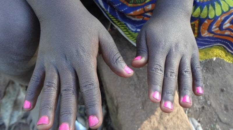 hands africa black mozambique
