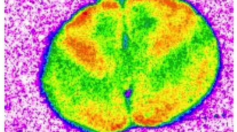 Representative autoradiogram of the brain depicting metabolic activity in the prefrontal cortex. Credit Francisco Mouro, iMM/FMUL.