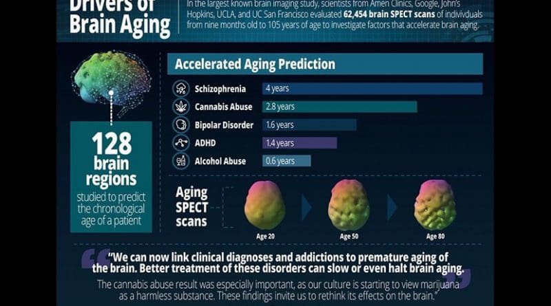 Drivers of Brain Aging