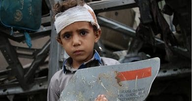 Photo by Yemeni photographer Ahmad Algohbarya, of a young survivor of August 9 Saudi-led attack on his school bus, with fragment of U.S. made missile