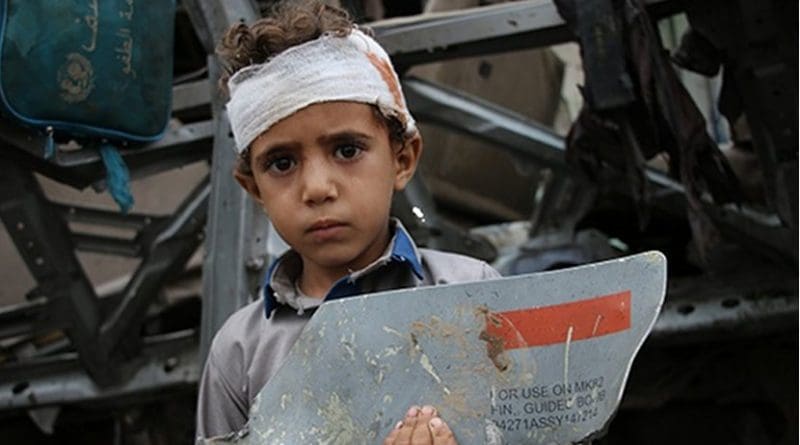 Photo by Yemeni photographer Ahmad Algohbarya, of a young survivor of August 9 Saudi-led attack on his school bus, with fragment of U.S. made missile