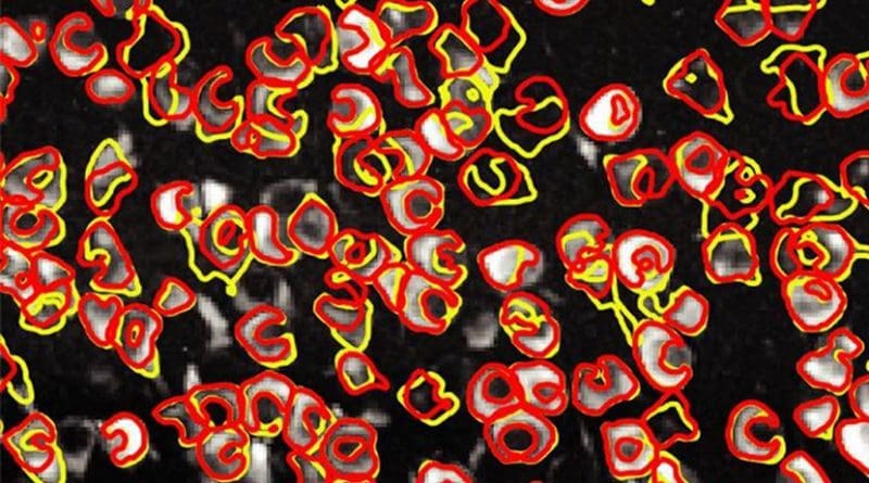 This is an image of neurons (white) taken using calcium imaging techniques. An innovative software dubbed CaImAn can automatically differentiate between individual neurons (yellow outlines) with nearly the same accuracy as a human (red outlines). Credit Giovannucci et al./eLife 2019