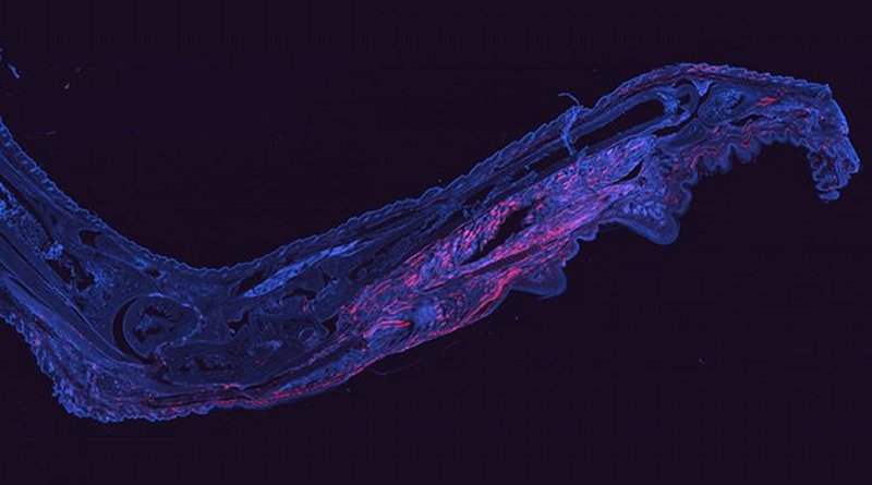 Cells harboring chikungunya virus (red) are visible in a mouse foot 28 days after infection. The virus is notorious for causing prolonged, painful arthritis that can last for years. Researchers at Washington University School of Medicine in St. Louis have developed a way to fluorescently tag cells infected with chikungunya virus. The technique opens up new avenues to study how the virus persists in the body and potentially could lead to a treatment.